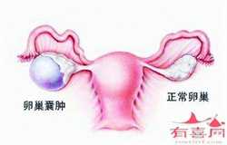 科学讲解孕妇什么时候开始补钙：北京男，找人